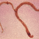 Necator americanus